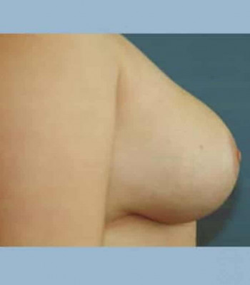 After Image
